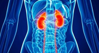 High Consumption of Soda and Soft Drinks increase the Risk of Kidney Disease